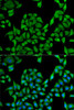 Immunofluorescence analysis of U2OS cells using UGT1A1 Polyclonal Antibody
