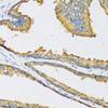 Immunohistochemistry of paraffin-embedded Human prostate using CXCL11 Polyclonal Antibody at dilution of  1:100 (40x lens).