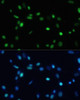 Immunofluorescence analysis of NIH-3T3 cells using SET Polyclonal Antibody at dilution of  1:100. Blue: DAPI for nuclear staining.