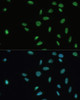 Immunofluorescence analysis of U-2 OS cells using SET Polyclonal Antibody at dilution of  1:100. Blue: DAPI for nuclear staining.