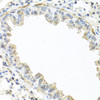 Immunohistochemistry of paraffin-embedded Mouse lung using IL22 Polyclonal Antibody at dilution of  1:100 (40x lens).