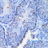 Immunohistochemistry of paraffin-embedded Mouse testis using CBX8 Polyclonal Antibody at dilution of  1:100 (40x lens).