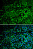 Immunofluorescence analysis of HeLa cells using TRIM13 Polyclonal Antibody