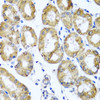 Immunohistochemistry of paraffin-embedded Human stomach using M6PR Polyclonal Antibody at dilution of  1:100 (40x lens).