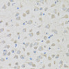 Immunohistochemistry of paraffin-embedded Mouse brain using PENK Polyclonal Antibody at dilution of  1:100 (40x lens).