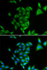 Immunofluorescence analysis of U2OS cells using PHYH Polyclonal Antibody