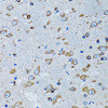Immunohistochemistry of paraffin-embedded Mouse brain using RARS Polyclonal Antibody at dilution of  1:100 (40x lens).