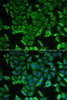 Immunofluorescence analysis of MCF-7 cells using RARS Polyclonal Antibody