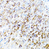 Immunohistochemistry of paraffin-embedded Mouse stomach using SERPINA7 Polyclonal Antibody at dilution of  1:100 (40x lens).
