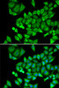 Immunofluorescence analysis of U2OS cells using DHRS9 Polyclonal Antibody