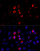 Immunofluorescence analysis of HeLa cells using BCAP29 Polyclonal Antibody at dilution of  1:100 (40x lens). Blue: DAPI for nuclear staining.