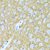 Immunohistochemistry of paraffin-embedded Rat brain using SYP Polyclonal Antibody at dilution of  1:100 (40x lens).