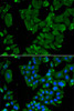 Immunofluorescence analysis of HeLa cells using DBN1 Polyclonal Antibody