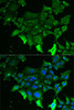 Immunofluorescence analysis of MCF7 cells using GRK6 Polyclonal Antibody