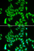 Immunofluorescence analysis of A549 cells using IREB2 Polyclonal Antibody