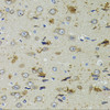 Immunohistochemistry of paraffin-embedded Rat brain using PTPN3 Polyclonal Antibody at dilution of  1:100 (40x lens).