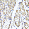 Immunohistochemistry of paraffin-embedded Human stomach using TNFAIP6 Polyclonal Antibody at dilution of  1:100 (40x lens).