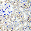Immunohistochemistry of paraffin-embedded Rat kidney using TNFAIP6 Polyclonal Antibody at dilution of  1:100 (40x lens).