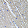 Immunohistochemistry of paraffin-embedded Mouse heart using TNFAIP6 Polyclonal Antibody at dilution of  1:100 (40x lens).