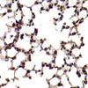 Immunohistochemistry of paraffin-embedded Mouse lung using SF1 Polyclonal Antibody at dilution of  1:100 (40x lens).