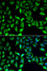 Immunofluorescence analysis of A549 cells using GDA Polyclonal Antibody