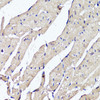 Immunohistochemistry of paraffin-embedded Mouse heart using ACSS2 Polyclonal Antibody at dilution of  1:100 (40x lens).