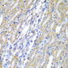 Immunohistochemistry of paraffin-embedded Rat kidney using CYP20A1 Polyclonal Antibody at dilution of  1:200 (40x lens).