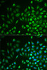 Immunofluorescence analysis of U2OS cells using LNX1 Polyclonal Antibody