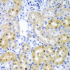Immunohistochemistry of paraffin-embedded Rat kidney using ADAD1 Polyclonal Antibody at dilution of  1:200 (40x lens).