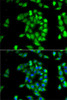 Immunofluorescence analysis of MCF7 cells using ANTXR1 Polyclonal Antibody