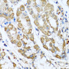 Immunohistochemistry of paraffin-embedded Human stomach using ANTXR2 Polyclonal Antibody at dilution of  1:100 (40x lens).