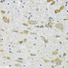 Immunohistochemistry of paraffin-embedded Mouse spinal cord using CCT4 Polyclonal Antibody at dilution of  1:100 (40x lens).