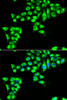 Immunofluorescence analysis of HeLa cells using CLDN2 Polyclonal Antibody