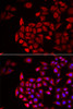 Immunofluorescence analysis of HeLa cells using COCH Polyclonal Antibody