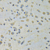Immunohistochemistry of paraffin-embedded Rat brain using DARS Polyclonal Antibody at dilution of  1:100 (40x lens).
