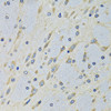 Immunohistochemistry of paraffin-embedded Mouse brain using DARS Polyclonal Antibody at dilution of  1:100 (40x lens).