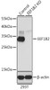 Western blot analysis of extracts from normal (control) and EEF1B2 knockout (KO) 293T cells using EEF1B2 Polyclonal Antibody at dilution of 1:1000.