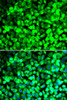 Immunofluorescence analysis of U2OS cells using EIF5 Polyclonal Antibody