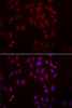 Immunofluorescence analysis of A549 cells using FRZB Polyclonal Antibody