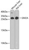 Western blot analysis of extracts of various cell lines using GM2A Polyclonal Antibody at dilution of 1:1000.