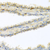 Immunohistochemistry of paraffin-embedded Human prostate using GPLD1 Polyclonal Antibody at dilution of  1:100 (40x lens).