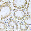Immunohistochemistry of paraffin-embedded Human stomach using HPS1 Polyclonal Antibody at dilution of  1:100 (40x lens).