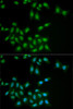 Immunofluorescence analysis of MCF7 cells using HPS1 Polyclonal Antibody