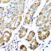 Immunohistochemistry of paraffin-embedded Human stomach using HYAL1 Polyclonal Antibody at dilution of  1:100 (40x lens).