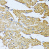 Immunohistochemistry of paraffin-embedded Mouse heart using IL20 Polyclonal Antibody at dilution of  1:100 (40x lens).