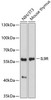 Western blot analysis of extracts of various cell lines using IL9R Polyclonal Antibody at dilution of 1:1000.