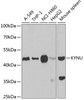 Western blot analysis of extracts of various cell lines using KYNU Polyclonal Antibody at dilution of 1:1000.