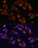 Immunofluorescence analysis of U-2 OS cells using MLPH Polyclonal Antibody at dilution of  1:100. Blue: DAPI for nuclear staining.