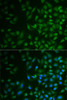 Immunofluorescence analysis of MCF7 cells using MPP2 Polyclonal Antibody