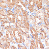 Immunohistochemistry of paraffin-embedded Human stomach using NHLRC1 Polyclonal Antibody at dilution of  1:100 (40x lens).